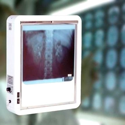 1-Screen X-Ray Film Viewer