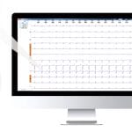 12-Channel Holter Monitor 2