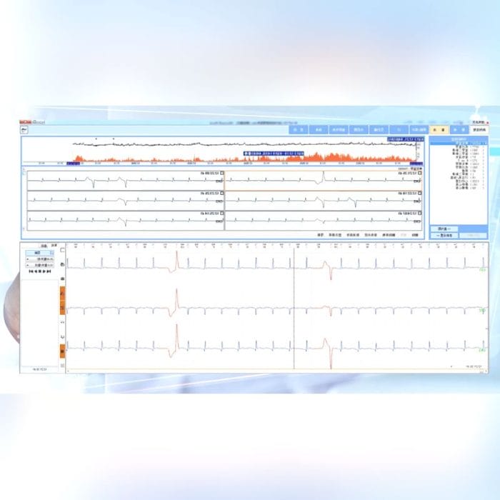 12-Channel Holter Monitor 3