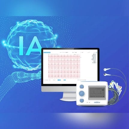 12-Channel Holter Monitor 1