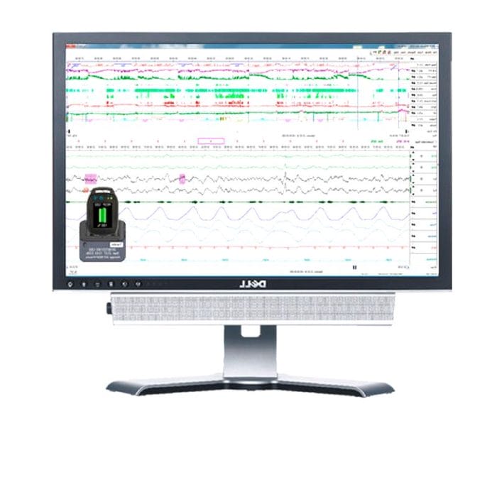 12-Channel Respiratory Polygraph 3