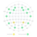 14-Channel Eeg System 3