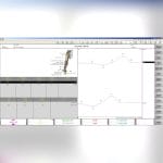 2-Channel Electromyograph 4