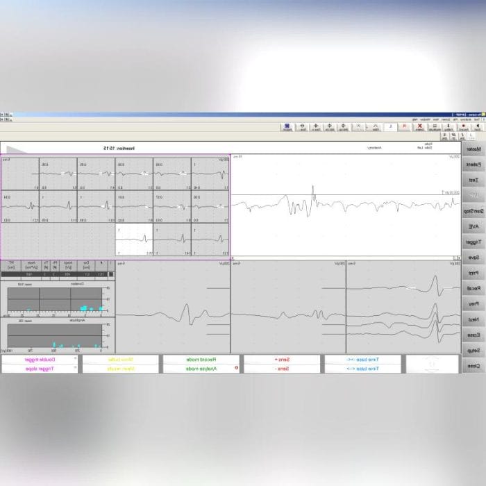 2-Channel Electromyograph 9