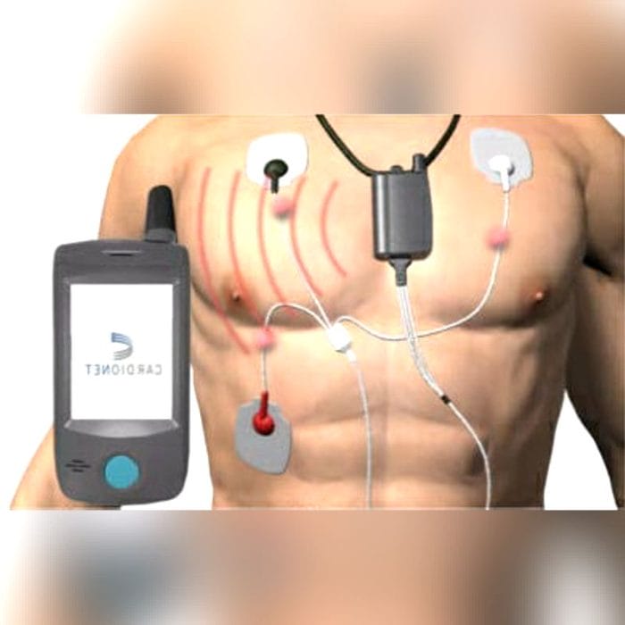 3-Channel Ecg Event Recorder 2