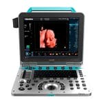 3D/4D Ultrasound System