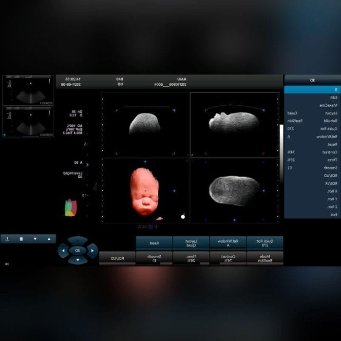 3D/4D Ultrasound System 6