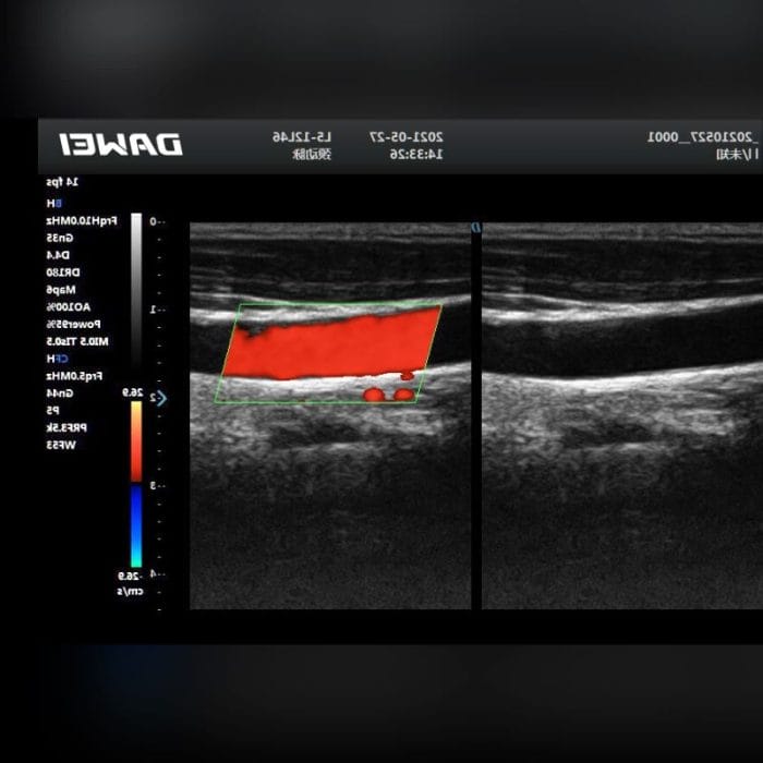 3D/4D Ultrasound System 8