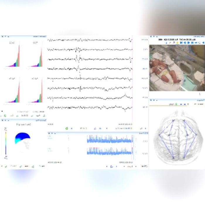 64-Channel Eeg System 4