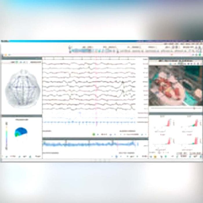 64-Channel Eeg System 5