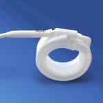 Adjustable Gastric Band 1