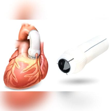 Ascending Aorta Vascular Prosthesis 1