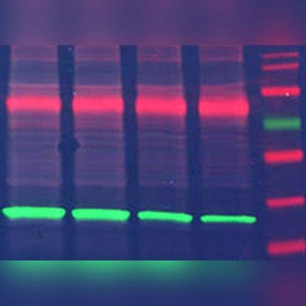 Automated Molecular Imaging System 1