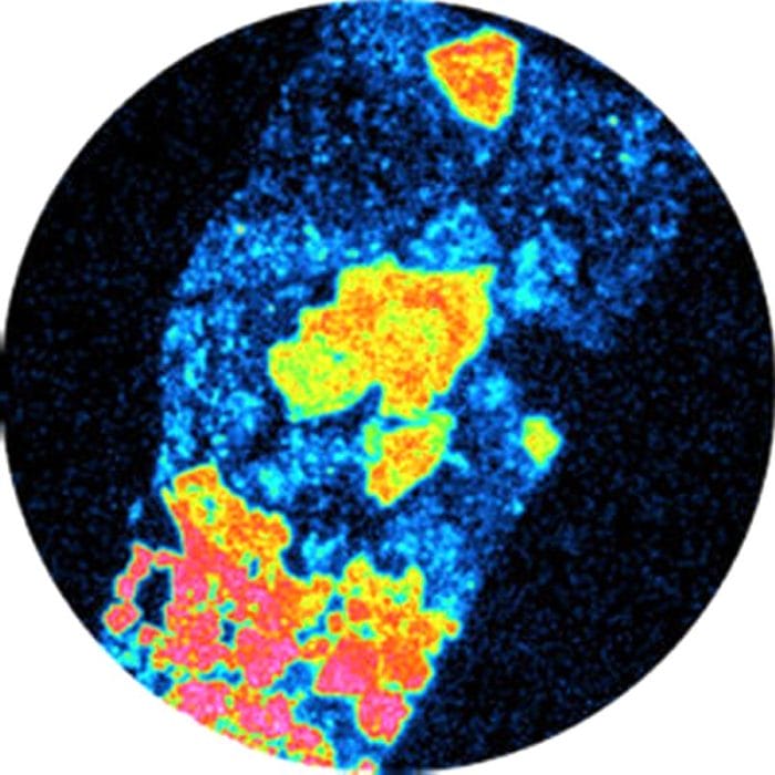 Autoradiography Preclinical Imaging System 5