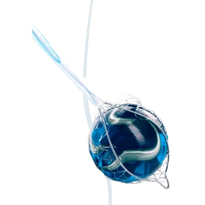 Biliary Stone Extraction Endoscopic Basket