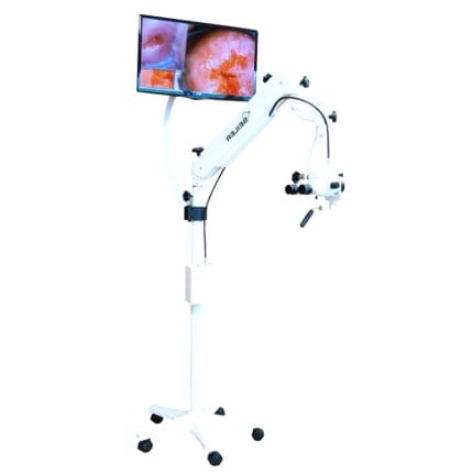 Binocular Colposcope 1