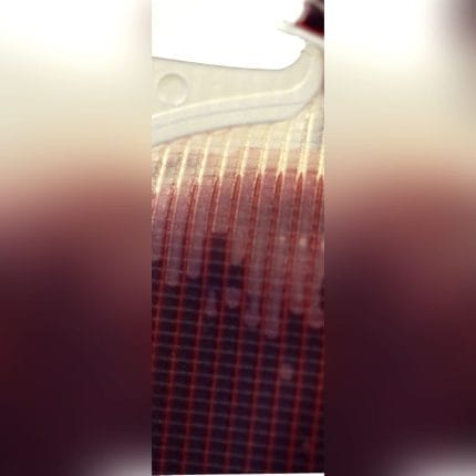 Blood Filter 1