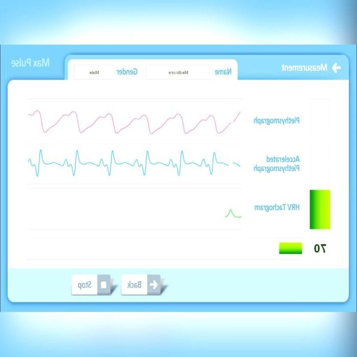 Body Photoplethysmograph 2