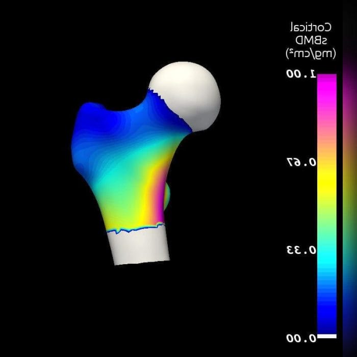 Bone Densitometry Software 1