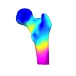 Bone Densitometry Software