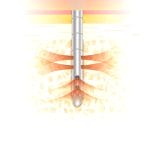 Bone Marrow Biopsy Needle 2