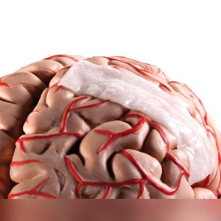 Bovine Pericardium Dural Substitute 1
