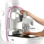 Breast Biopsy System