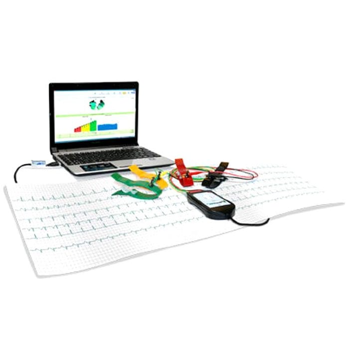 Cardiac Mapping System 1