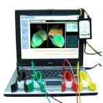 Cardiac Mapping System