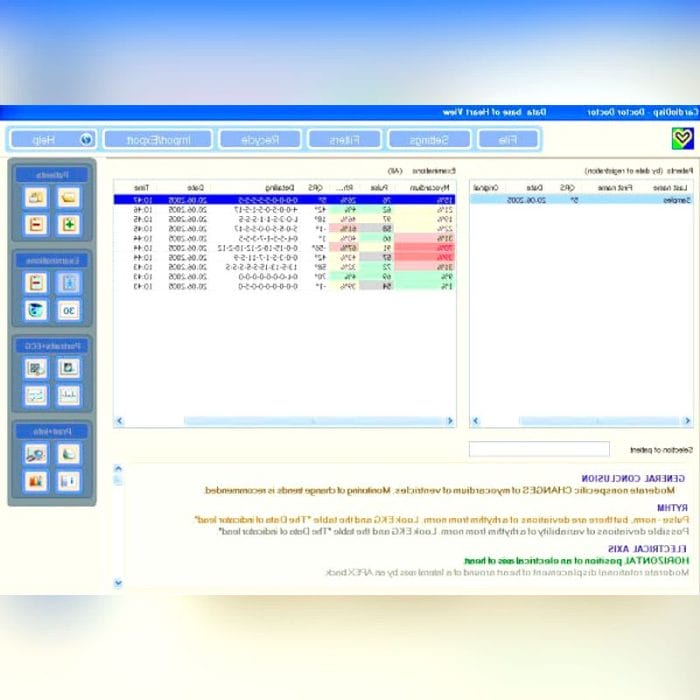 Cardiac Mapping System 3