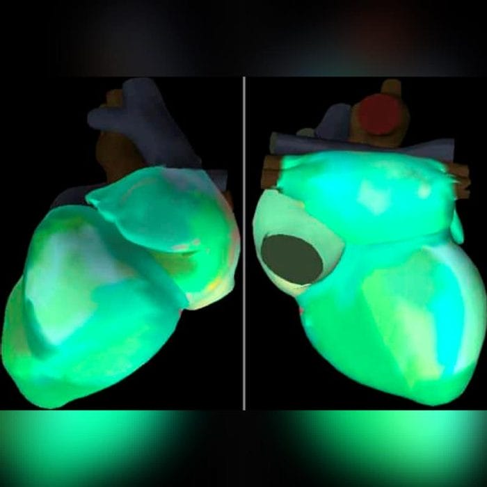 Cardiac Mapping System 4