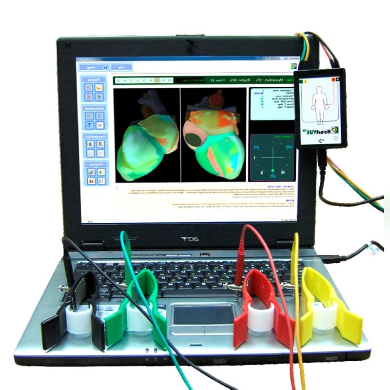 Cardiac Mapping System