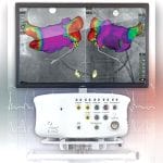 Cardiac Mapping System 2