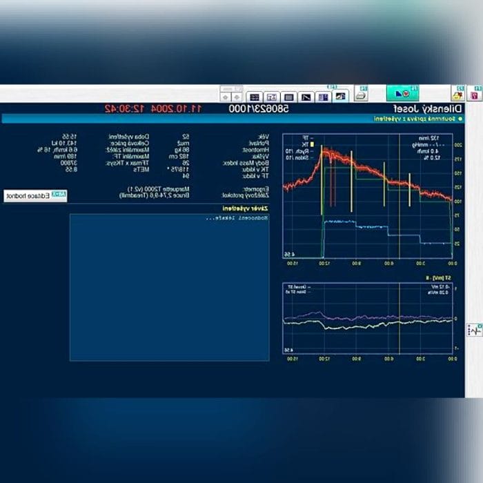 Cardiac Stress Test Equipment 2