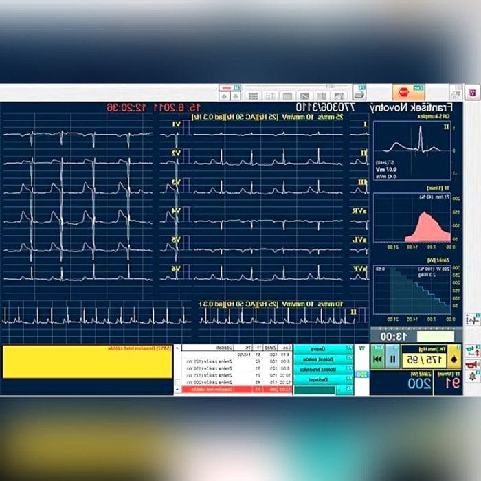 Cardiac Stress Test Equipment 4