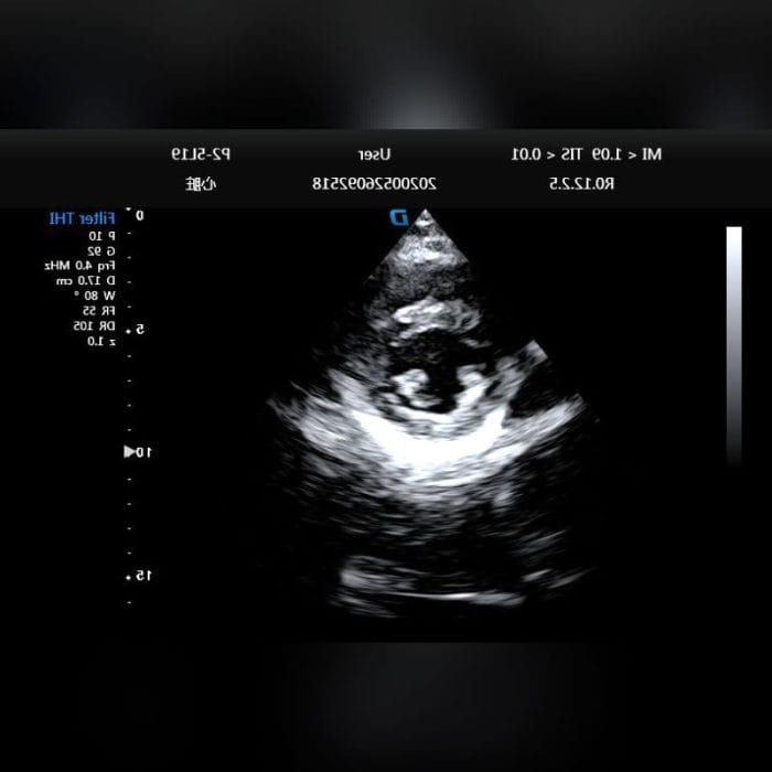 Cardiovascular Ultrasound Imaging System 5