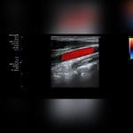 Cardiovascular Ultrasound Imaging System 7