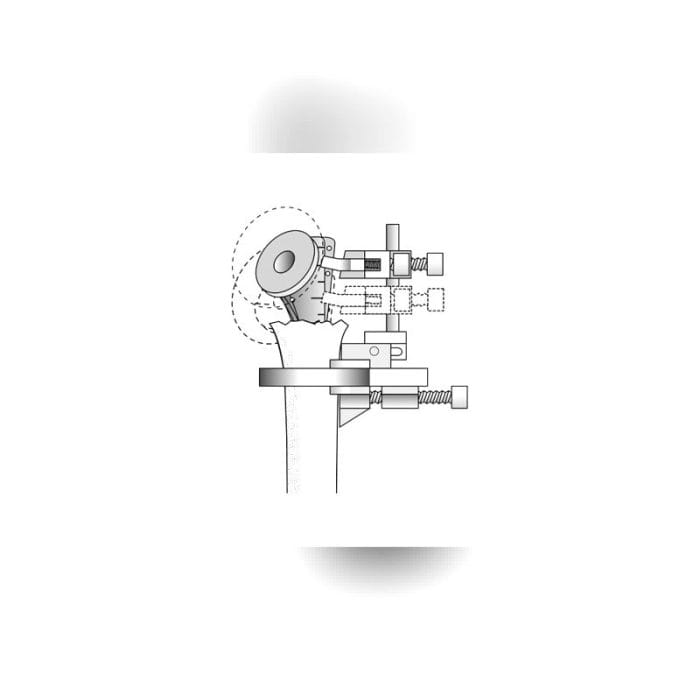 Cemented Or Non-Cemented Humeral Stem 9