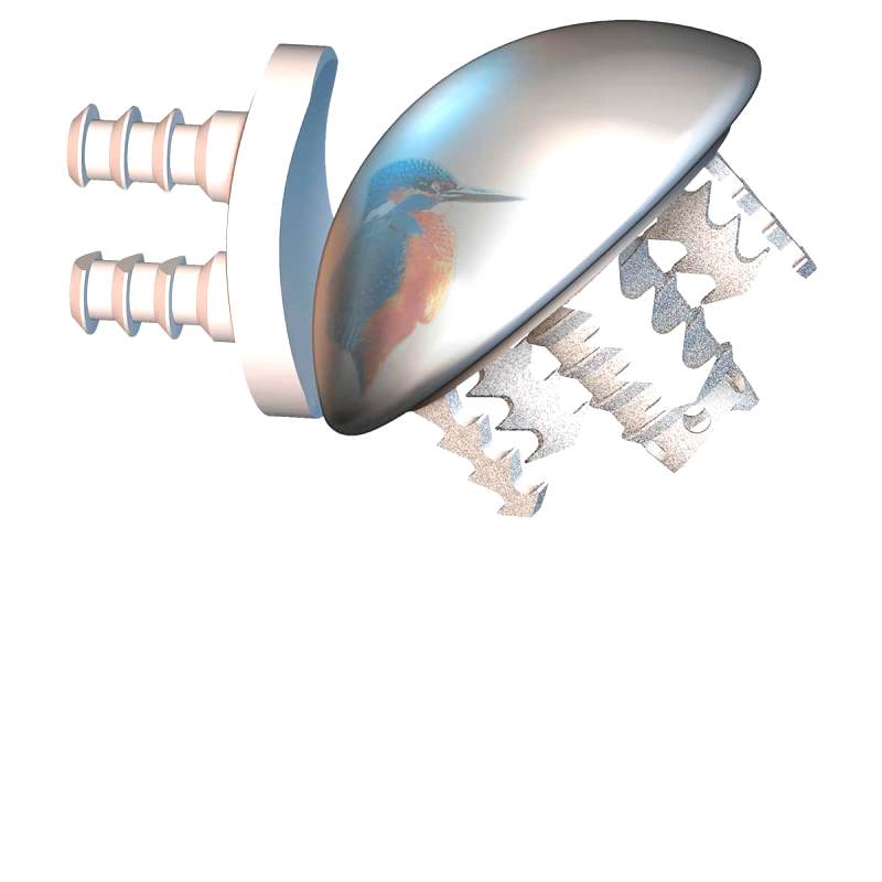 Cementless Humeral Head Prosthesis