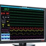 Central Patient Monitoring Station 3