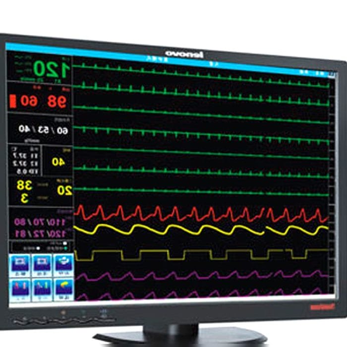 Central Patient Monitoring Station 3