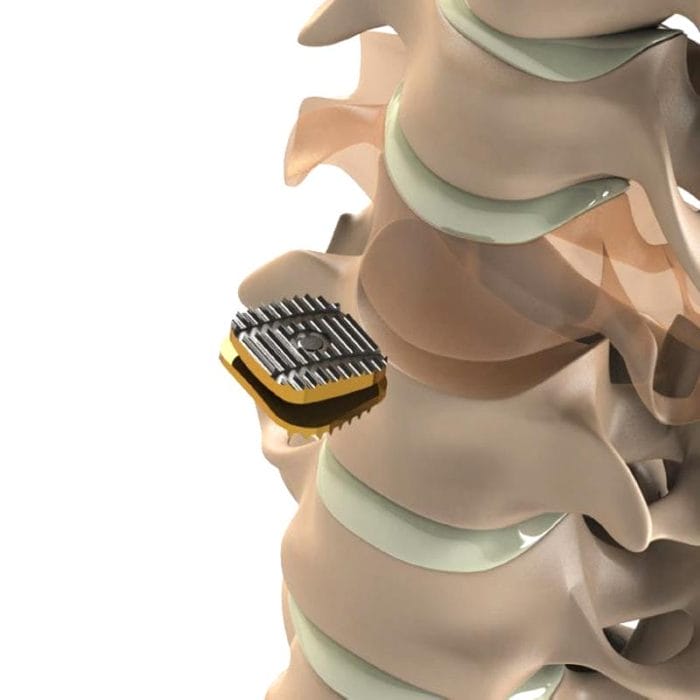 Cervical Disc Prosthesis 2