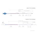 Chronic Total Occlusion Catheter 1