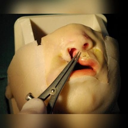 Cleft Lip Surgery Simulator 1