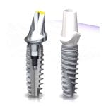 Conical Dental Implant 1