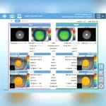 Corneal Topographer 3