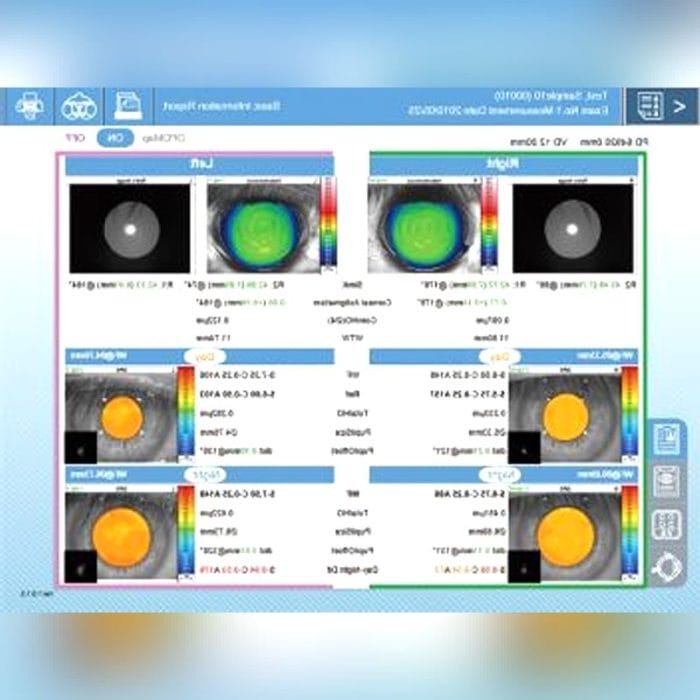 Corneal Topographer 3