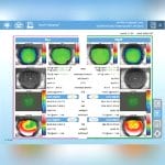 Corneal Topographer 4