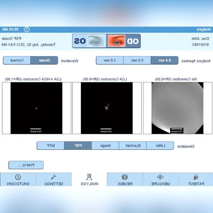 Corneal Topographer 5