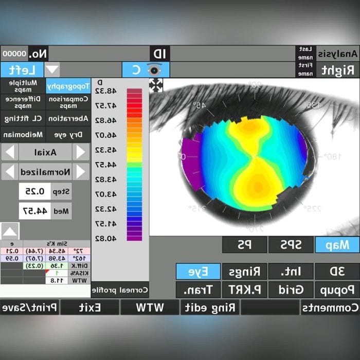 Corneal Topographer 3